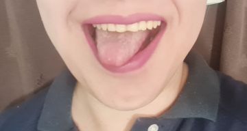 Masajista Gay, cipolletti,